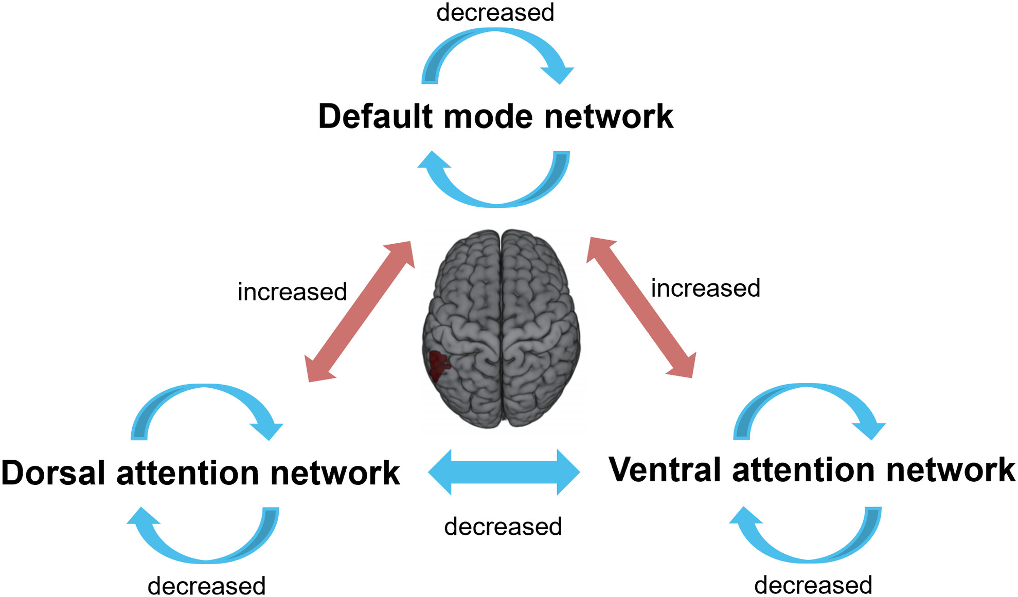 Interference of default mode on attention networks in adults with attention-deficit/hyperactivity disorder and its association with genetic variants and treatment outcomes