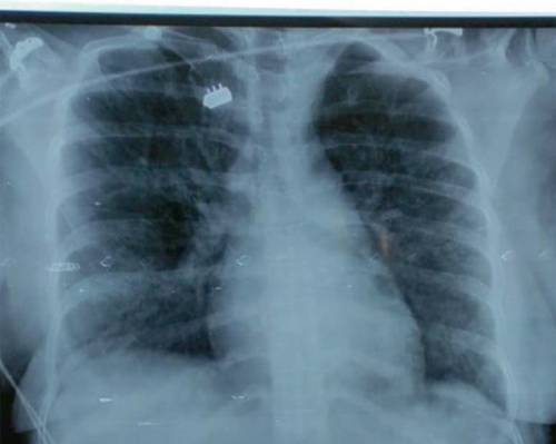 Details are in the caption following the image