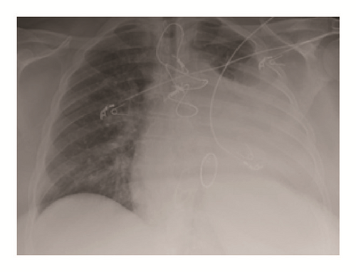 Details are in the caption following the image