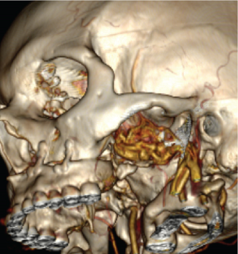Details are in the caption following the image Details are in the caption following the image