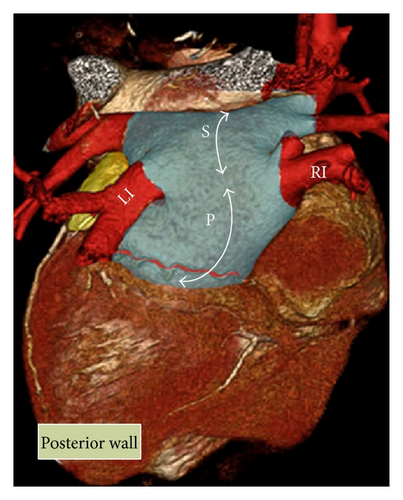 Details are in the caption following the image