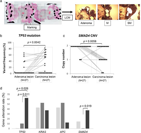 Genetic alterations related to endoscopic treatment of colorectal tumors
