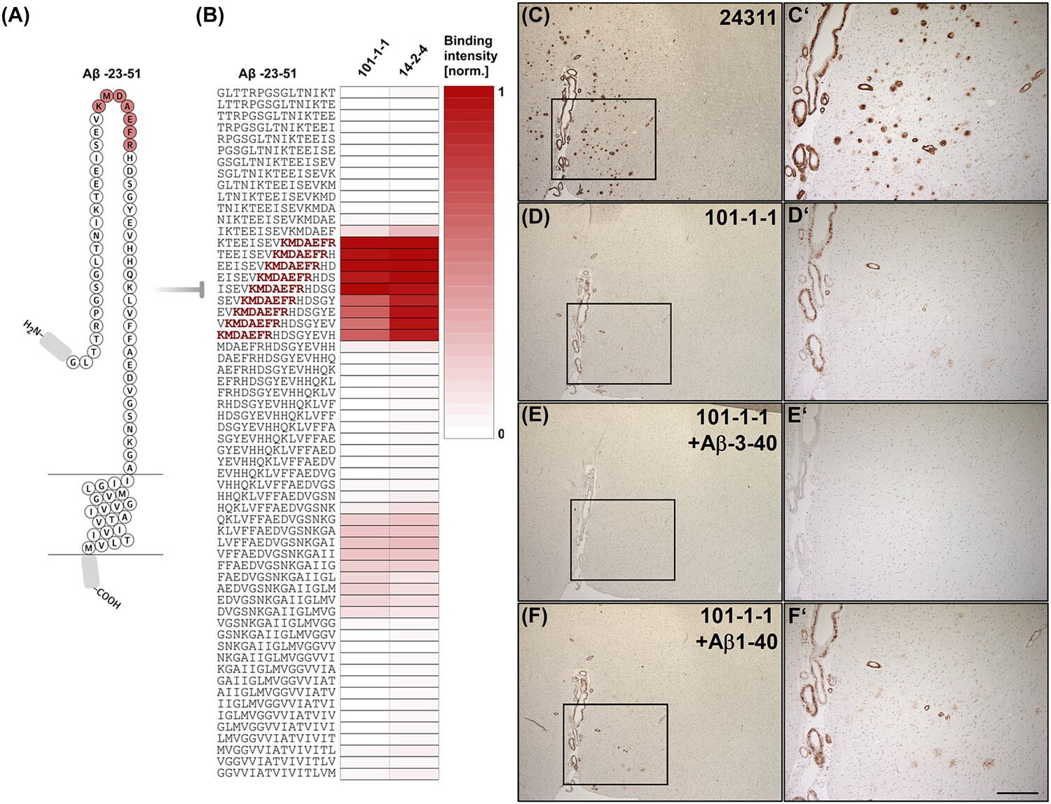 Amino-terminally elongated Aβ peptides are generated by the secreted metalloprotease ADAMTS4 and deposit in a subset of Alzheimer's disease brains