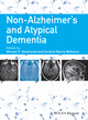 Non-Alzheimer's and Atypical Dementia cover image