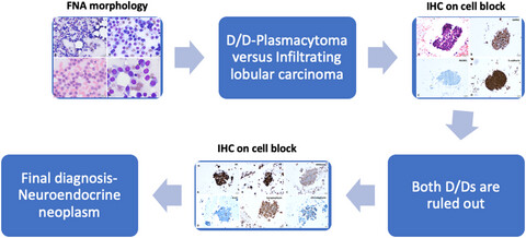 Neither Russell nor Magenta bodies: A cytological dilemma in breast fine needle aspiration cytology