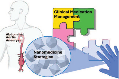 Recent Advances in Nanomedicine-Mediated Abdominal Aortic Aneurysm Treatment