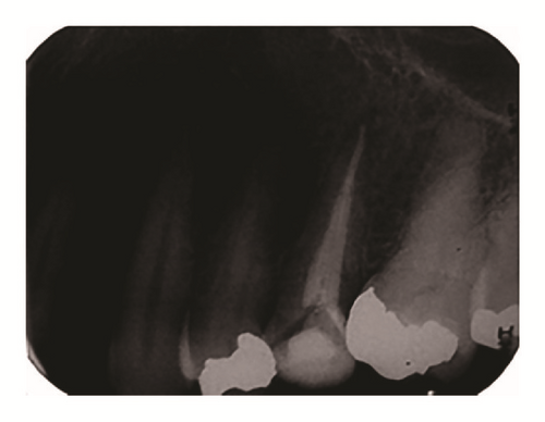 Details are in the caption following the image