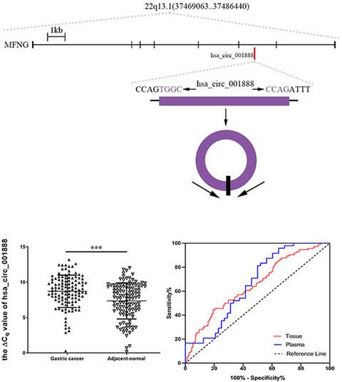 Reduced expression of circRNA hsa_circ_001888 in gastric cancer and its clinical significance