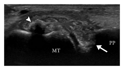 Details are in the caption following the image