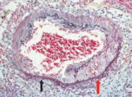 Details are in the caption following the image