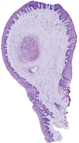 Details are in the caption following the image