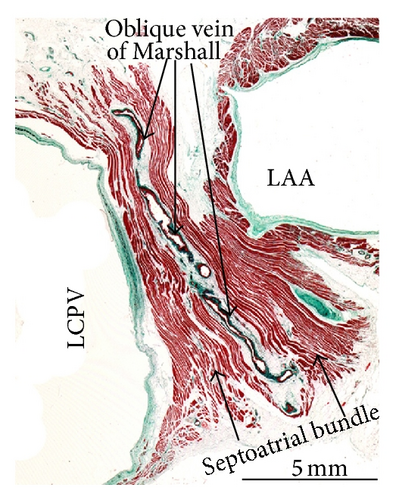 Details are in the caption following the image