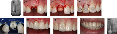 Details are in the caption following the image Details are in the caption following the image