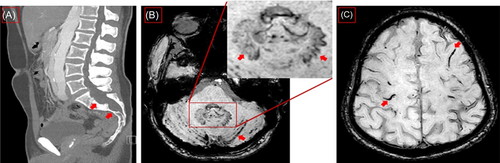 Details are in the caption following the image Details are in the caption following the image