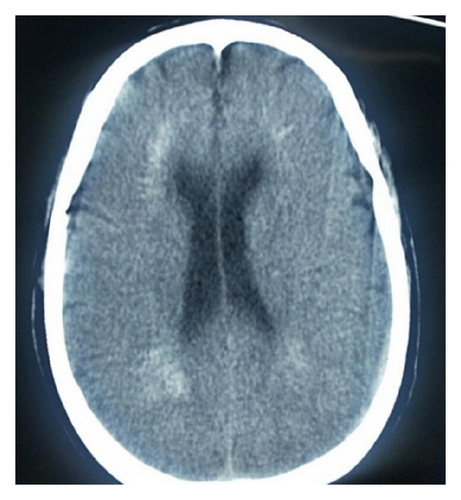 Details are in the caption following the image