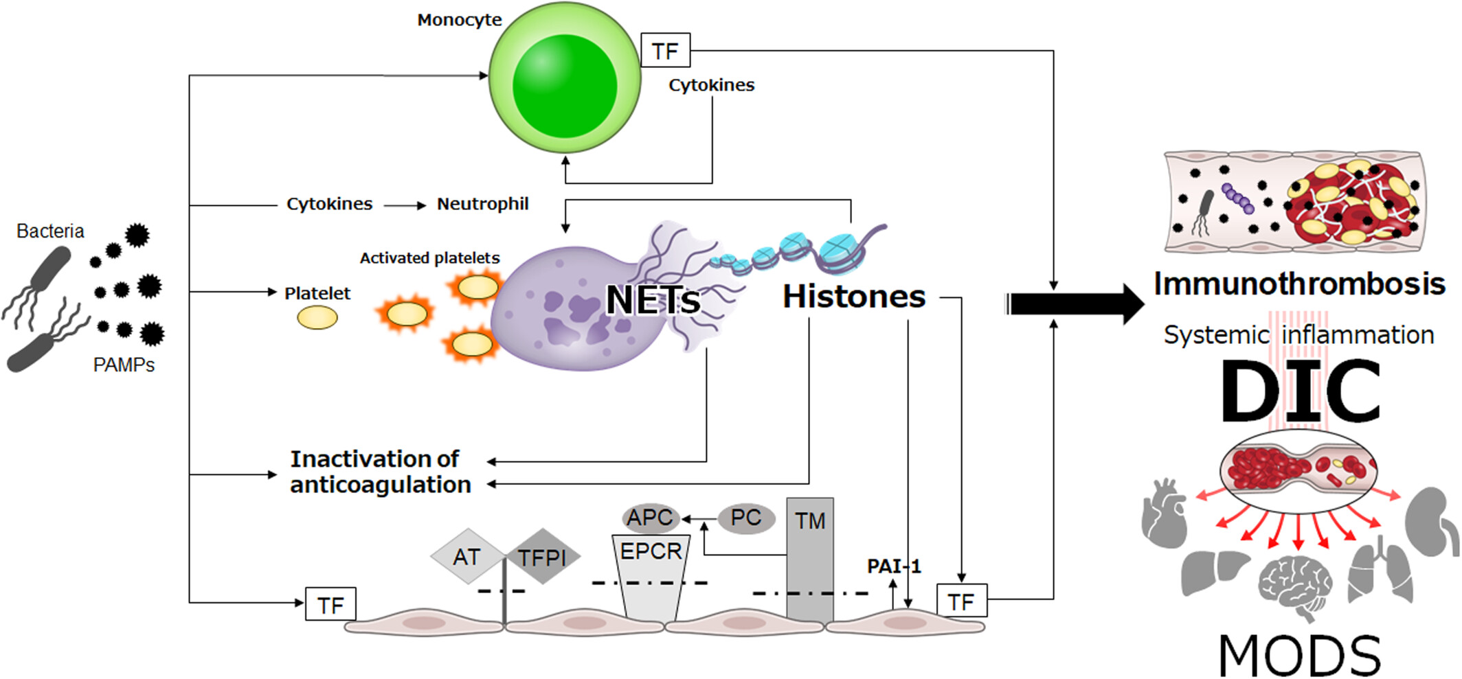 Sepsis-induced disseminated intravascular coagulation: an international estrangement of disease concept