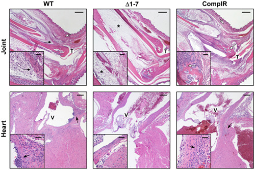 A small intergenic region of lp17 is required for evasion of adaptive immunity and induction of pathology by the Lyme disease spirochete