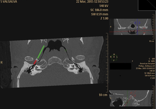 Details are in the caption following the image Details are in the caption following the image