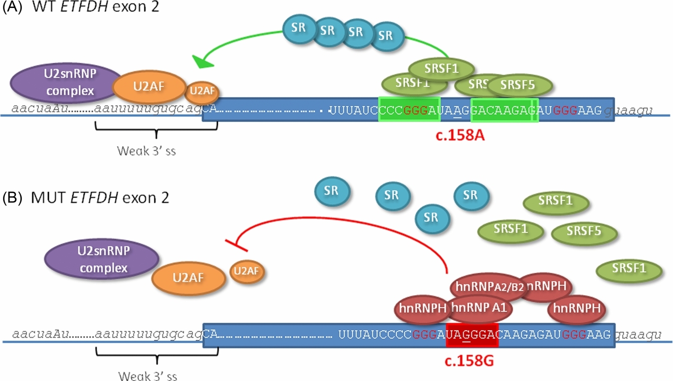 The ETFDH c.158A>G Variation Disrupts the Balanced Interplay of ESE- and ESS-Binding Proteins thereby Causing Missplicing and Multiple Acyl-CoA Dehydrogenation Deficiency