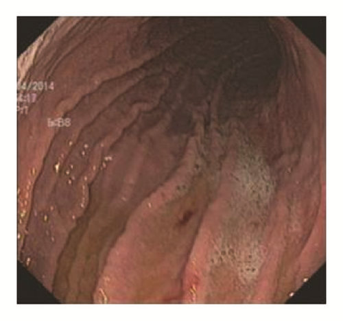 Details are in the caption following the image Details are in the caption following the image