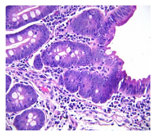 Details are in the caption following the image
