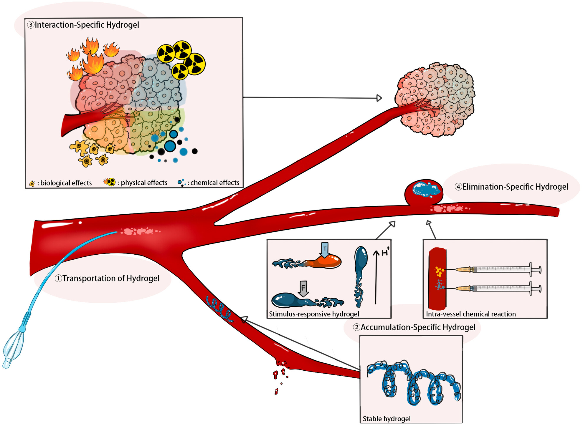 Advancements in hydrogel-based embolic agents: Categorized by therapeutic mechanisms