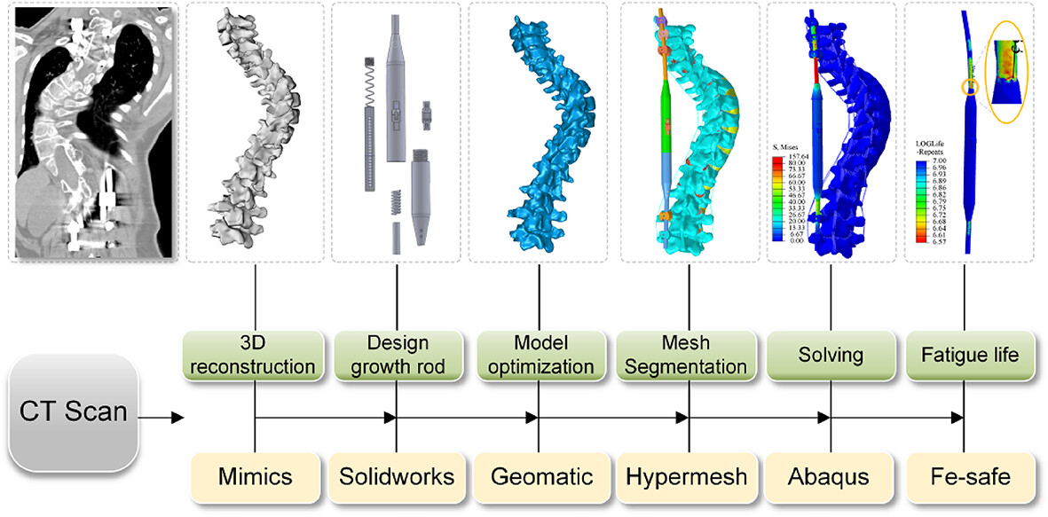 A Novel Dynamic Growth Rod Inducing Spinal Growth Modulation for the Correction of Spinal Deformities