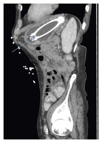 Details are in the caption following the image Details are in the caption following the image