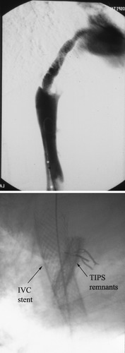 Details are in the caption following the image