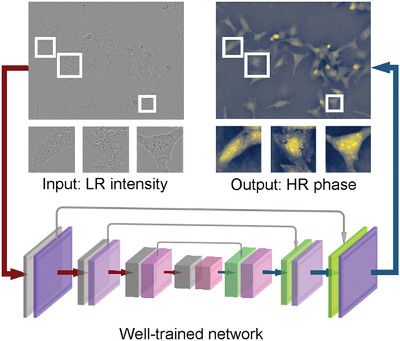 Deep Learning-Enabled Pixel-Super-Resolved Quantitative Phase Microscopy from Single-Shot Aliased Intensity Measurement