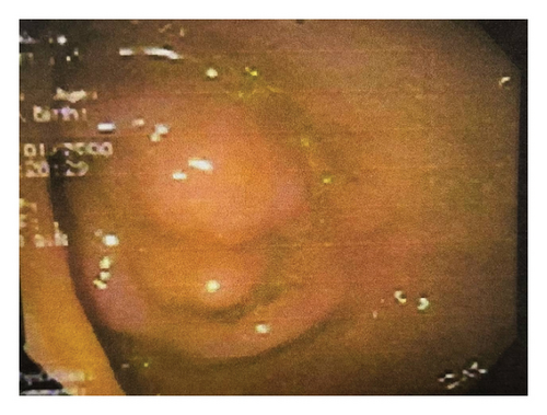 Details are in the caption following the image Details are in the caption following the image