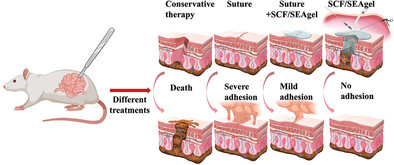 In Situ Forming Injectable Gelatin-Based Antibacterial Bioadhesives for Preventing Postoperative Leakage and Abdominal Adhesions