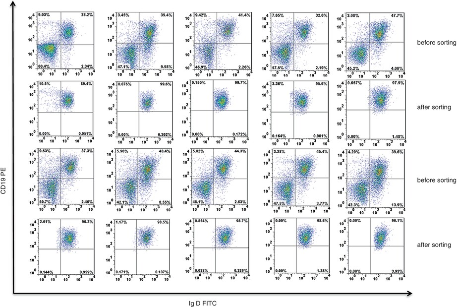 Expression of RAG and secondary gene rearrangement of BCR in mature peripheral B lymphocytes in Takayasu arteritis
