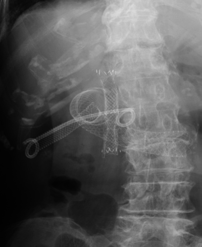 Details are in the caption following the image