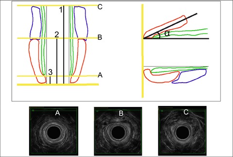 Synchronized functional anal sphincter assessment: maximizing the potential of anal vector manometry and 3-D anal endosonography