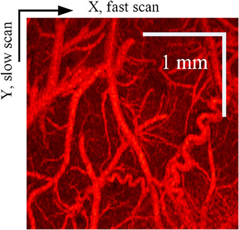 Quantitative assessment of optical coherence tomography angiography algorithms for neuroimaging