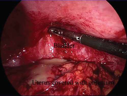 Details are in the caption following the image Details are in the caption following the image