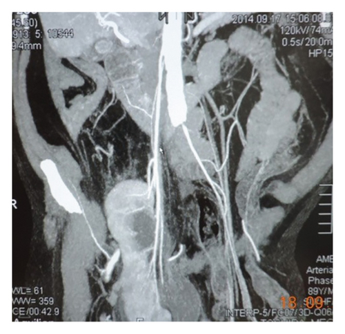 Details are in the caption following the image