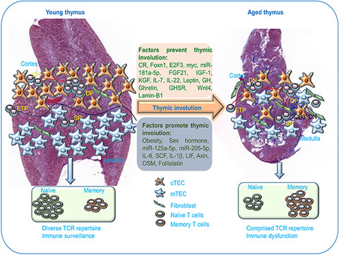 Age-related thymic involution: Mechanisms and functional impact