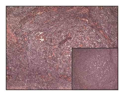Details are in the caption following the image