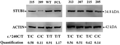 STUB1 polyadenylation signal variant AACAAA does not affect polyadenylation but decreases STUB1 translation causing SCAR16