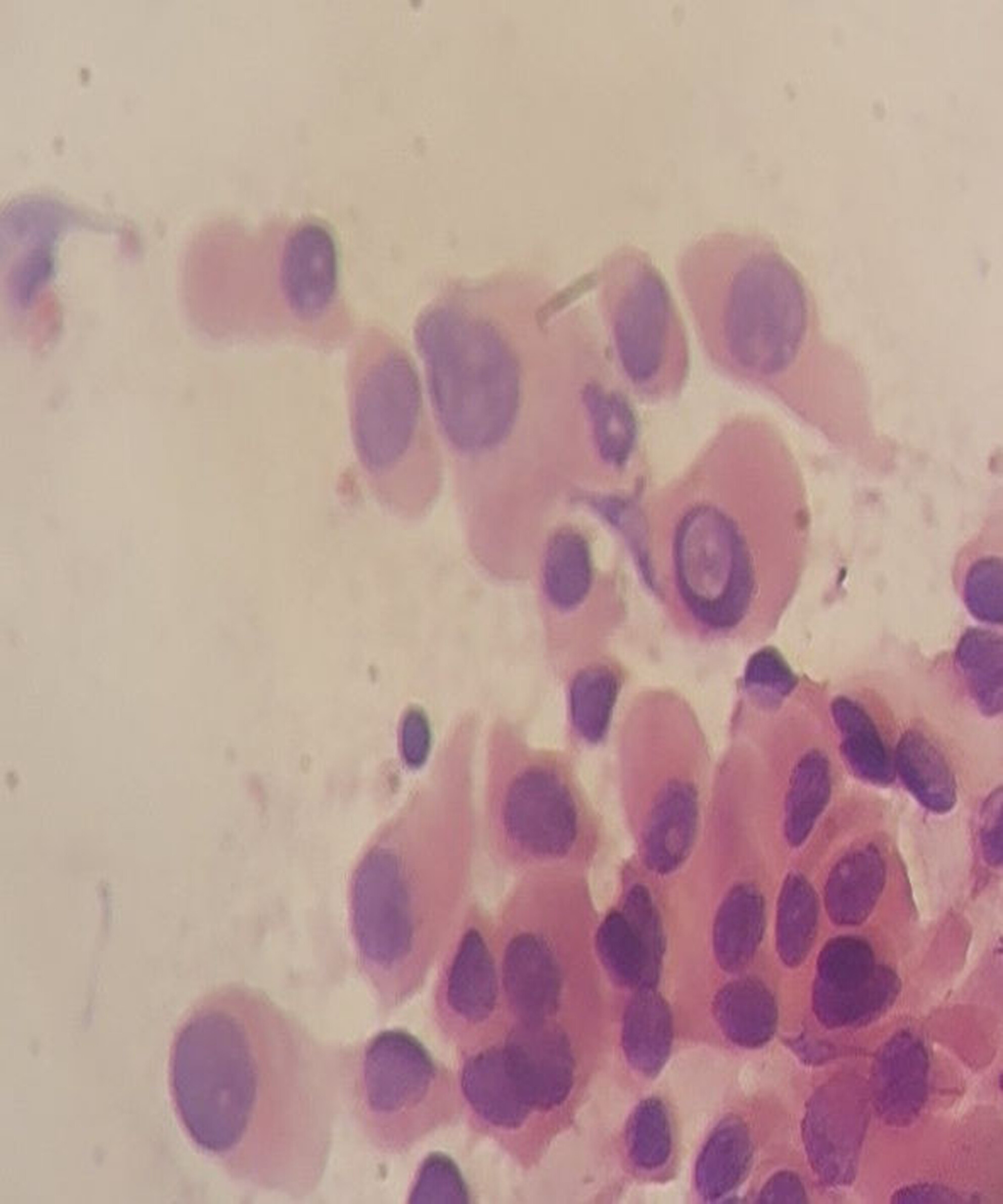 Accuracy of ultrasound-guided fine-needle aspiration cytology in evaluation of thyroid nodules using different ultrasonographic and cytological features