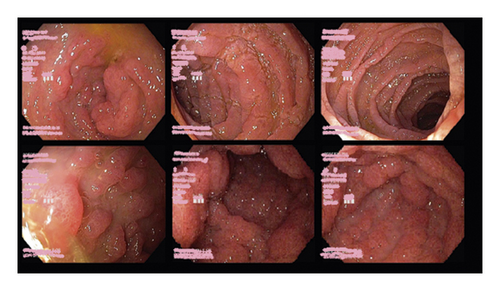 Details are in the caption following the image Details are in the caption following the image