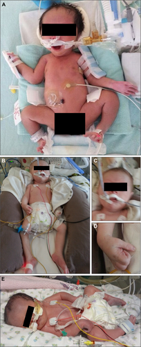 Details are in the caption following the image Details are in the caption following the image