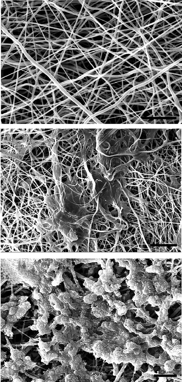 Generation of insulin-producing cells from human adipose-derived mesenchymal stem cells on PVA scaffold by optimized differentiation protocol