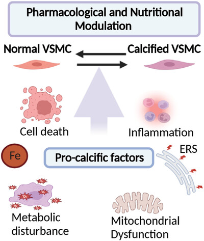 Vascular calcification: Molecular mechanisms and therapeutic interventions