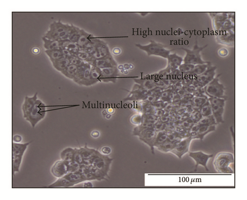 Details are in the caption following the image