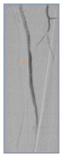 Details are in the caption following the image