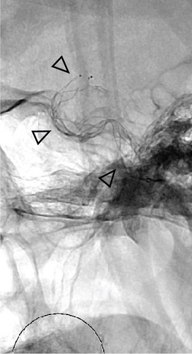 Details are in the caption following the image