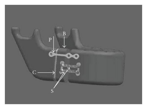 Details are in the caption following the image